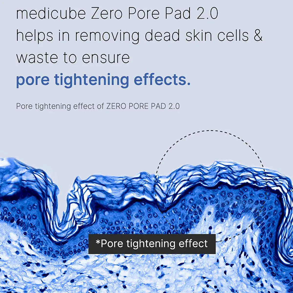 Zero Pore Rescue Pads
