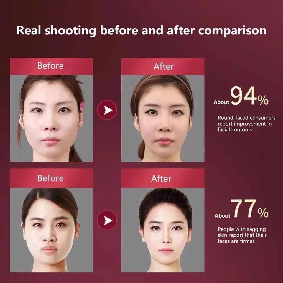 V-Shape Sonic Facial Sculpting Device
